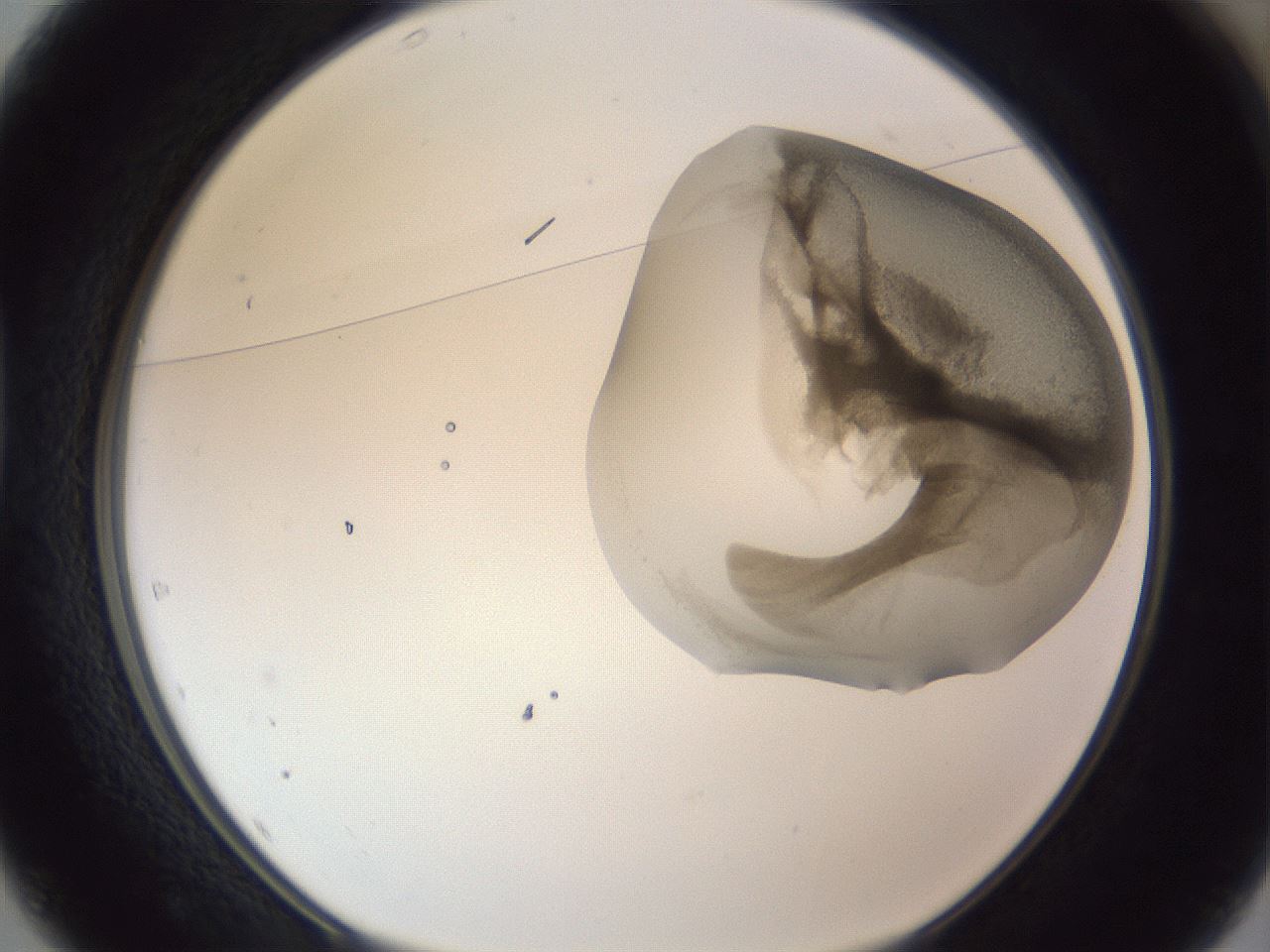 folderID164_plateID1164_batchID3211_wellNum37_profileID1_d1_r63847_ef.jpg