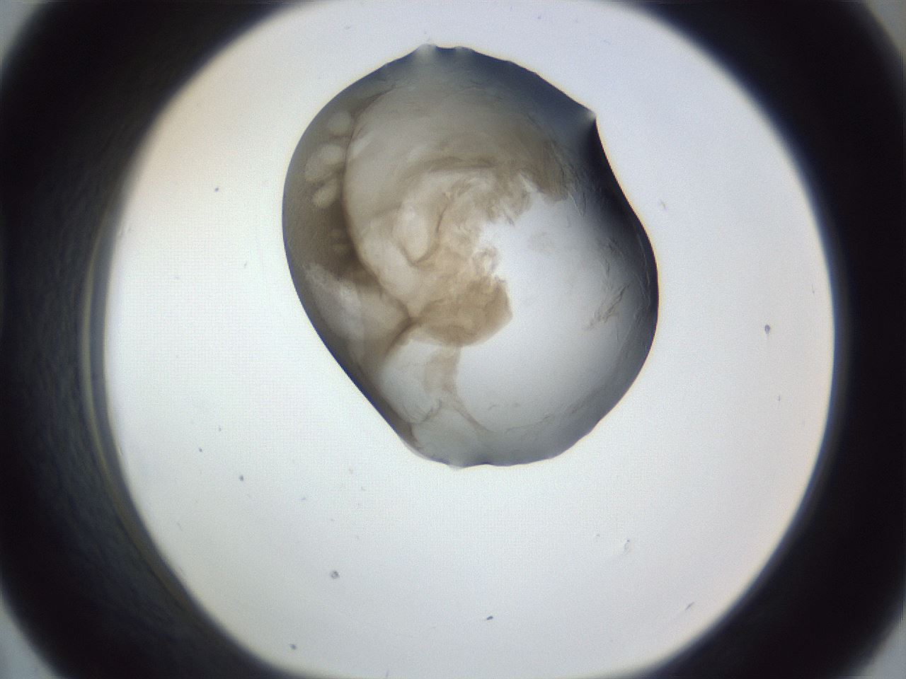 folderID164_plateID1164_batchID3211_wellNum43_profileID1_d1_r63859_ef.jpg