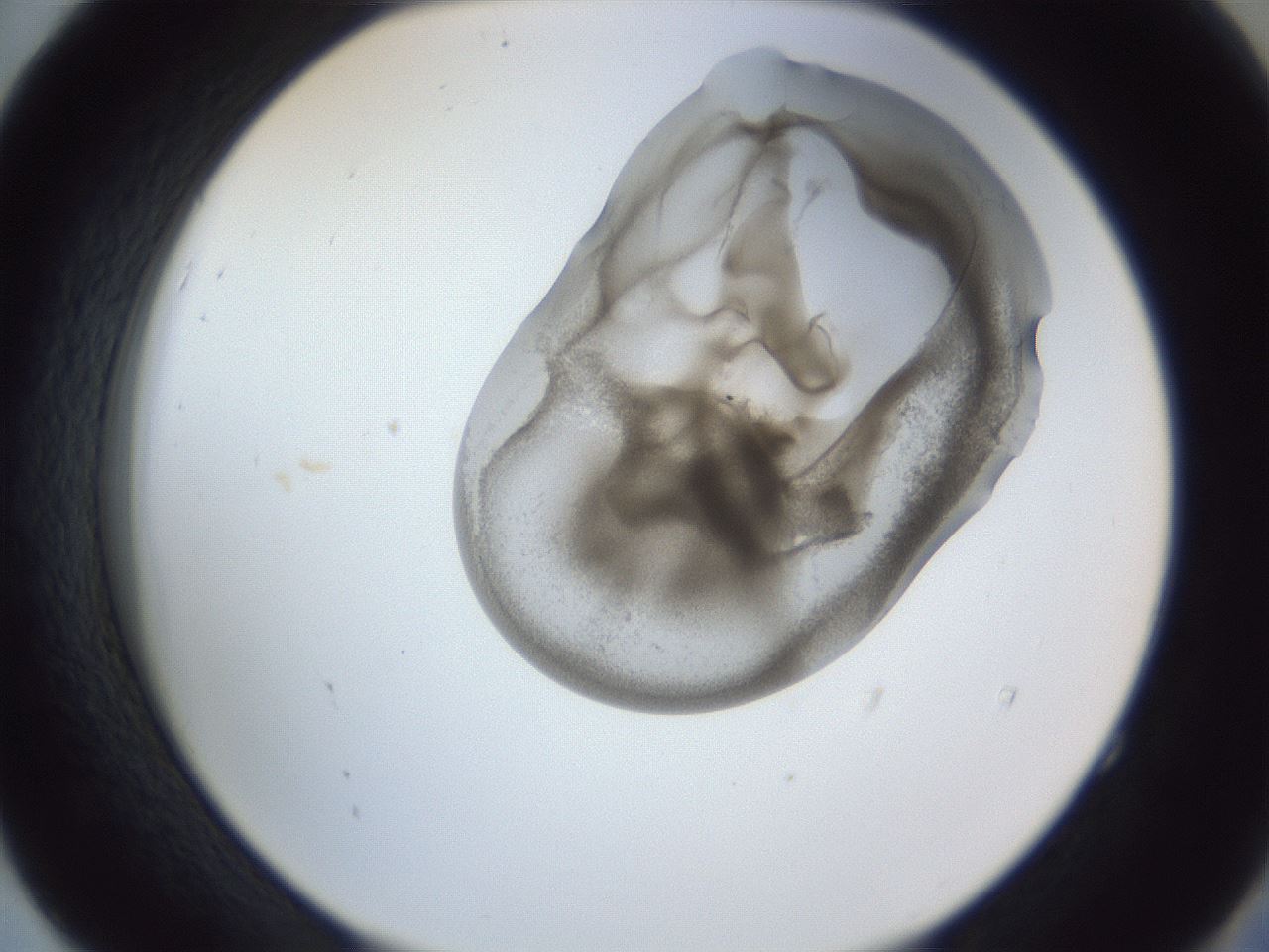 folderID164_plateID1164_batchID3211_wellNum52_profileID1_d2_r63878_ef.jpg