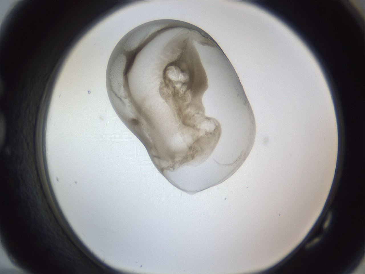 folderID164_plateID1164_batchID3211_wellNum82_profileID1_d1_r63937_ef.jpg