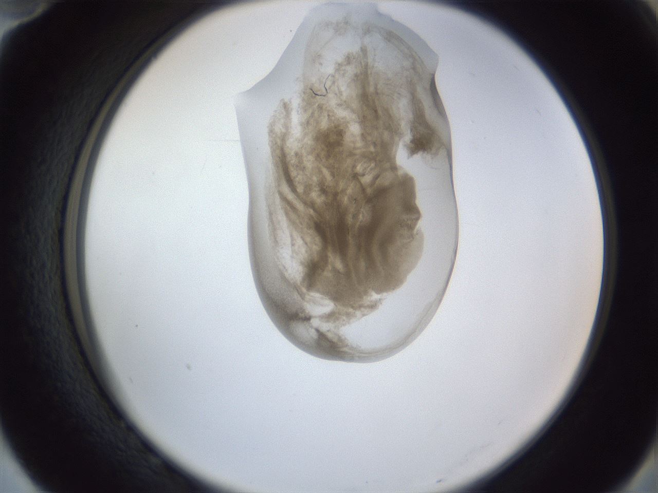 folderID164_plateID1164_batchID3211_wellNum82_profileID1_d2_r63938_ef.jpg