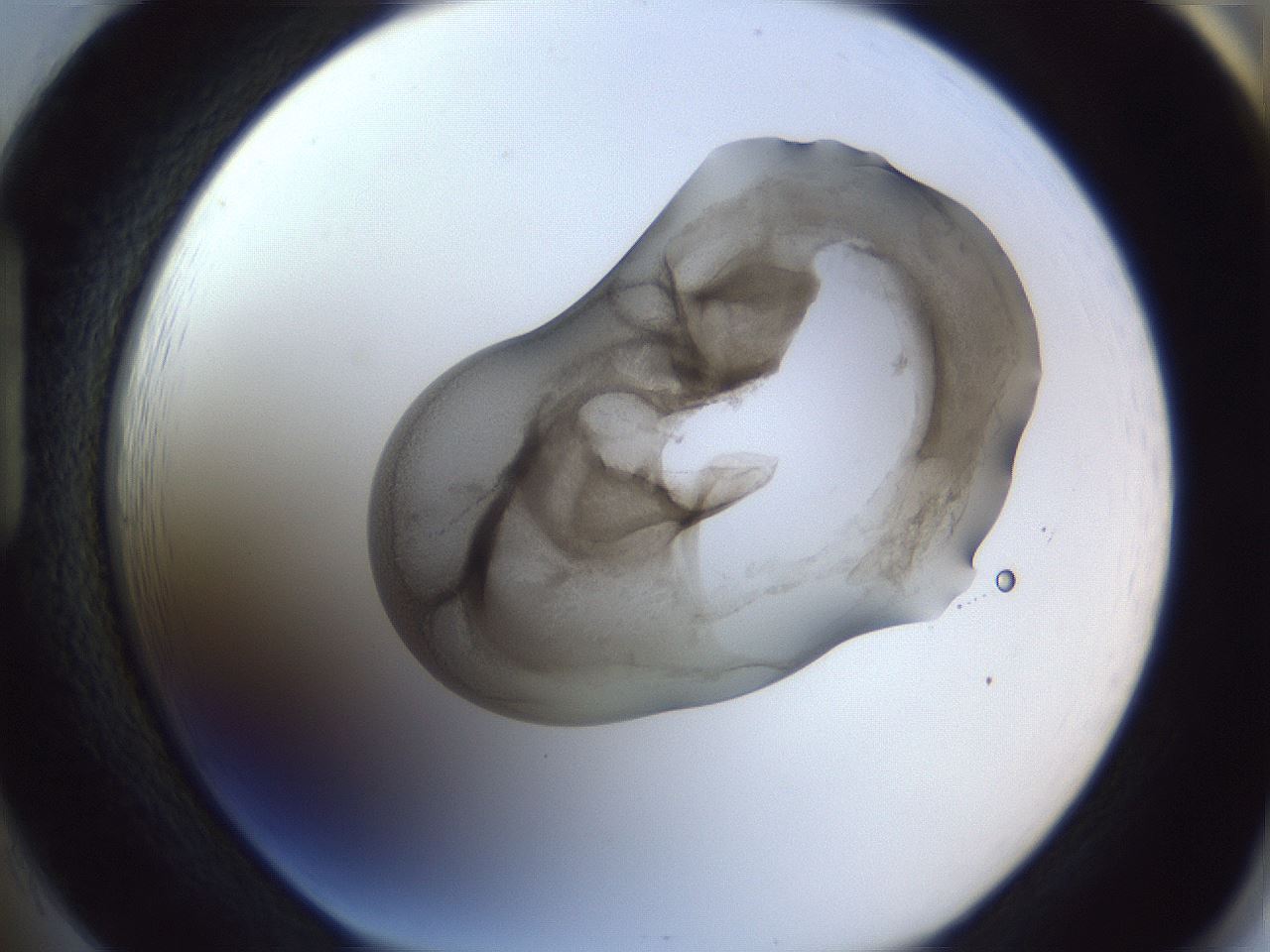 folderID164_plateID1164_batchID3211_wellNum85_profileID1_d1_r63943_ef.jpg