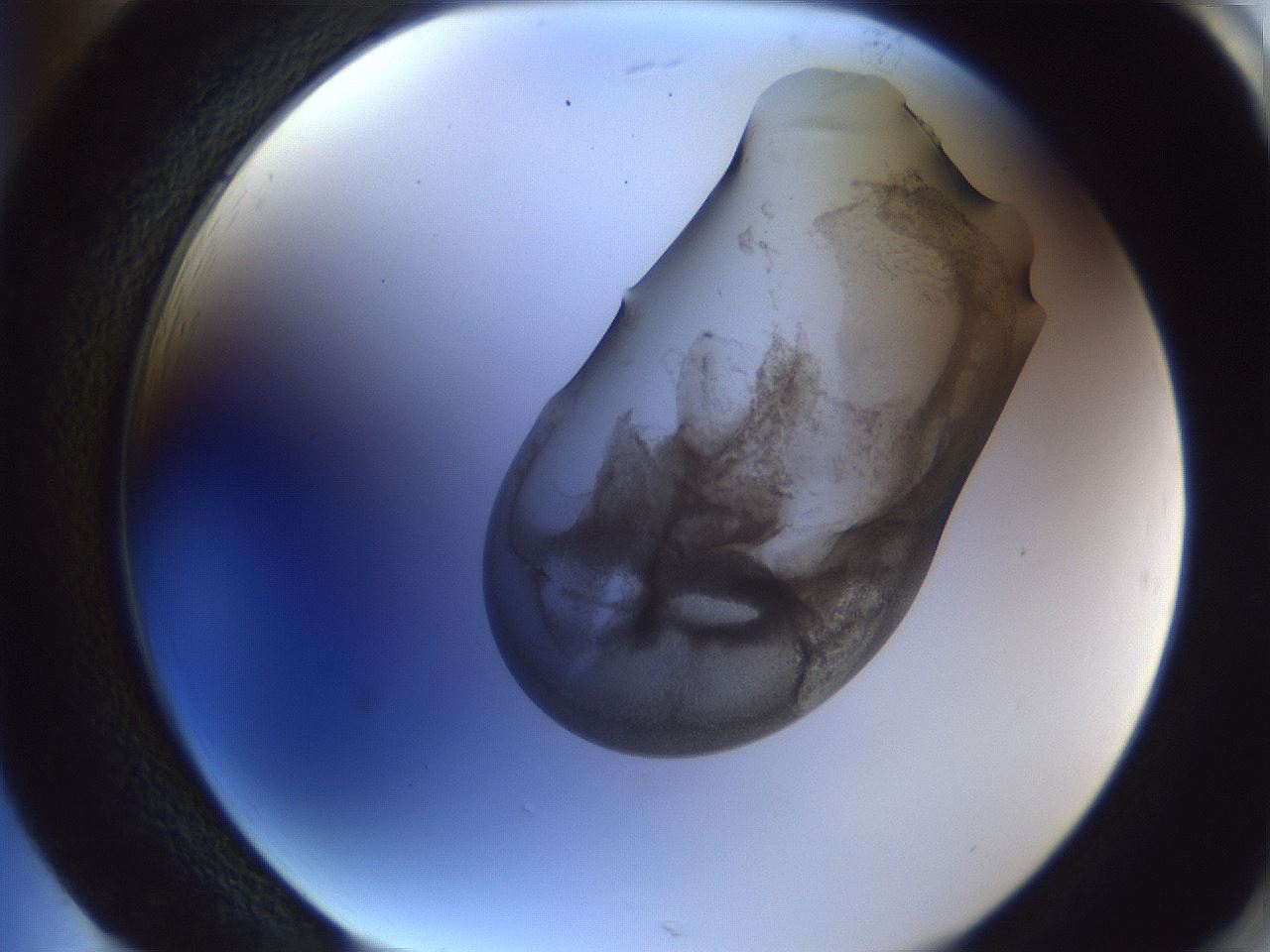 folderID164_plateID1164_batchID3211_wellNum85_profileID1_d2_r63944_ef.jpg