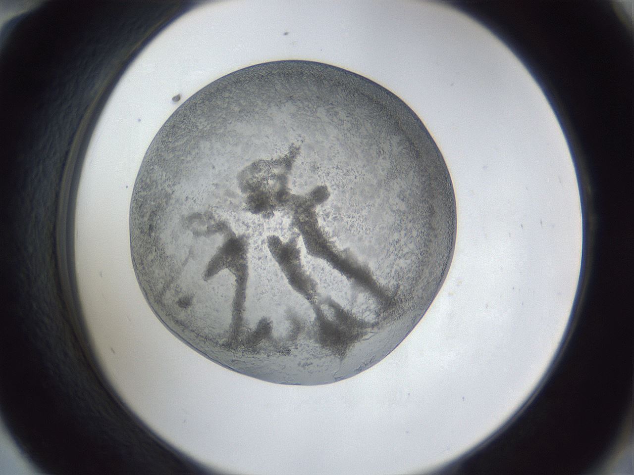 folderID165_plateID1165_batchID3120_wellNum58_profileID1_d2_r61202_ef.jpg