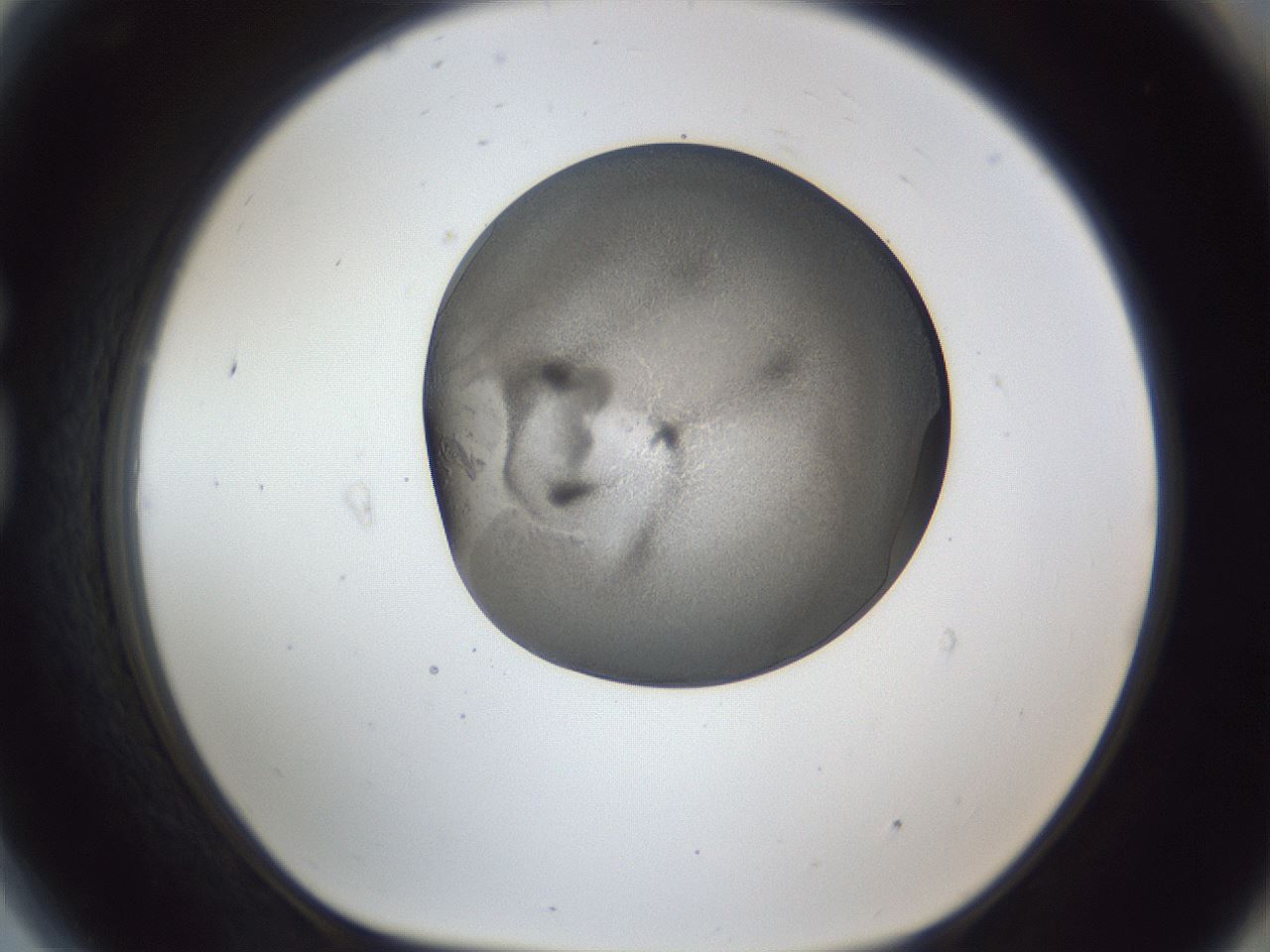 folderID165_plateID1165_batchID3120_wellNum81_profileID1_d1_r61247_ef.jpg