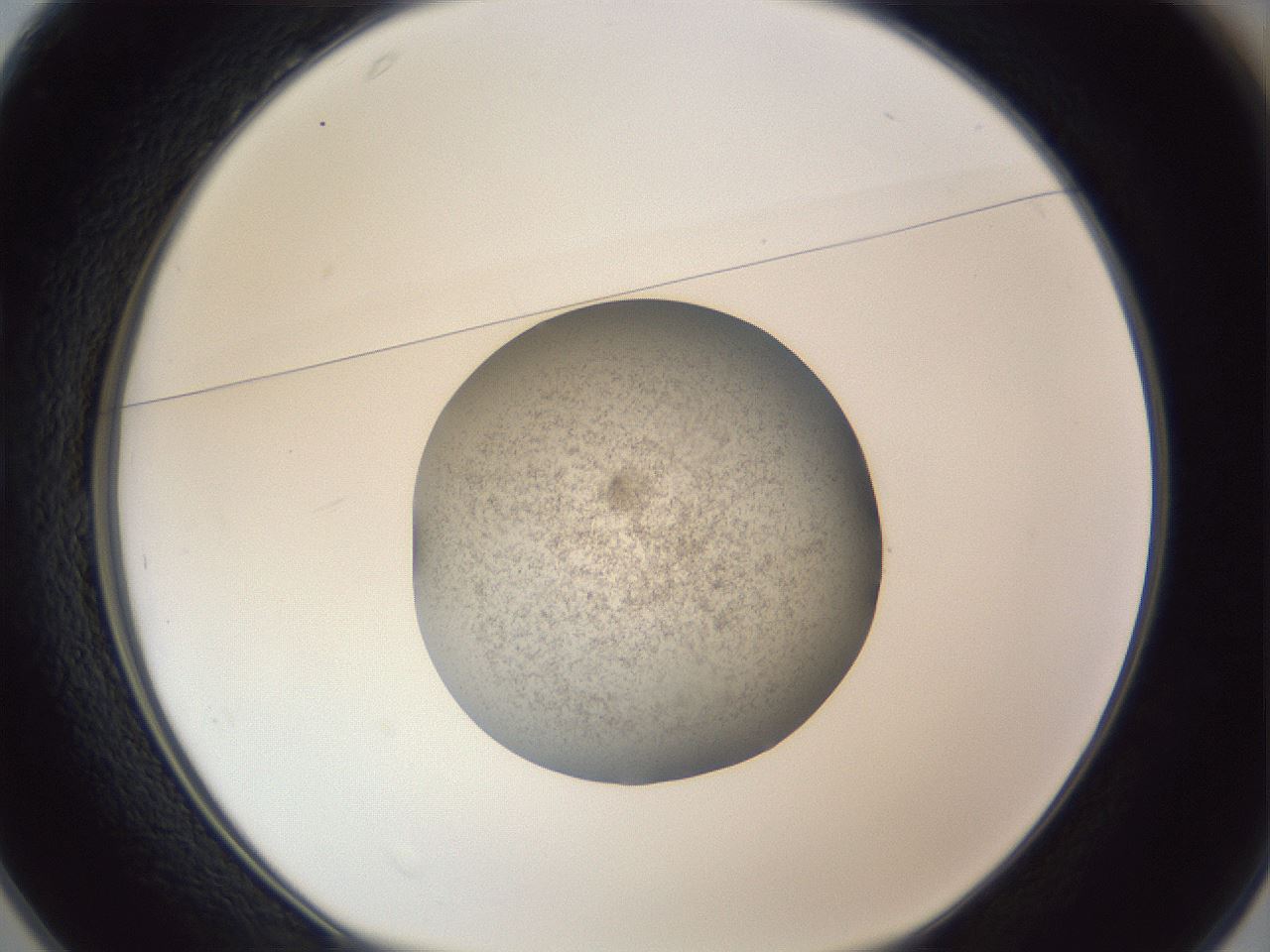 folderID252_plateID1252_batchID3997_wellNum25_profileID1_d1_r72510_ef.jpg