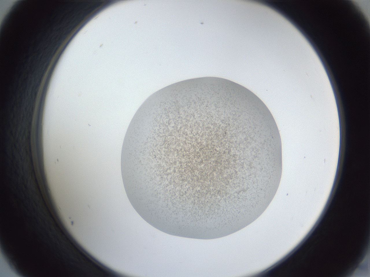 folderID252_plateID1252_batchID3997_wellNum45_profileID1_d2_r72551_ef.jpg