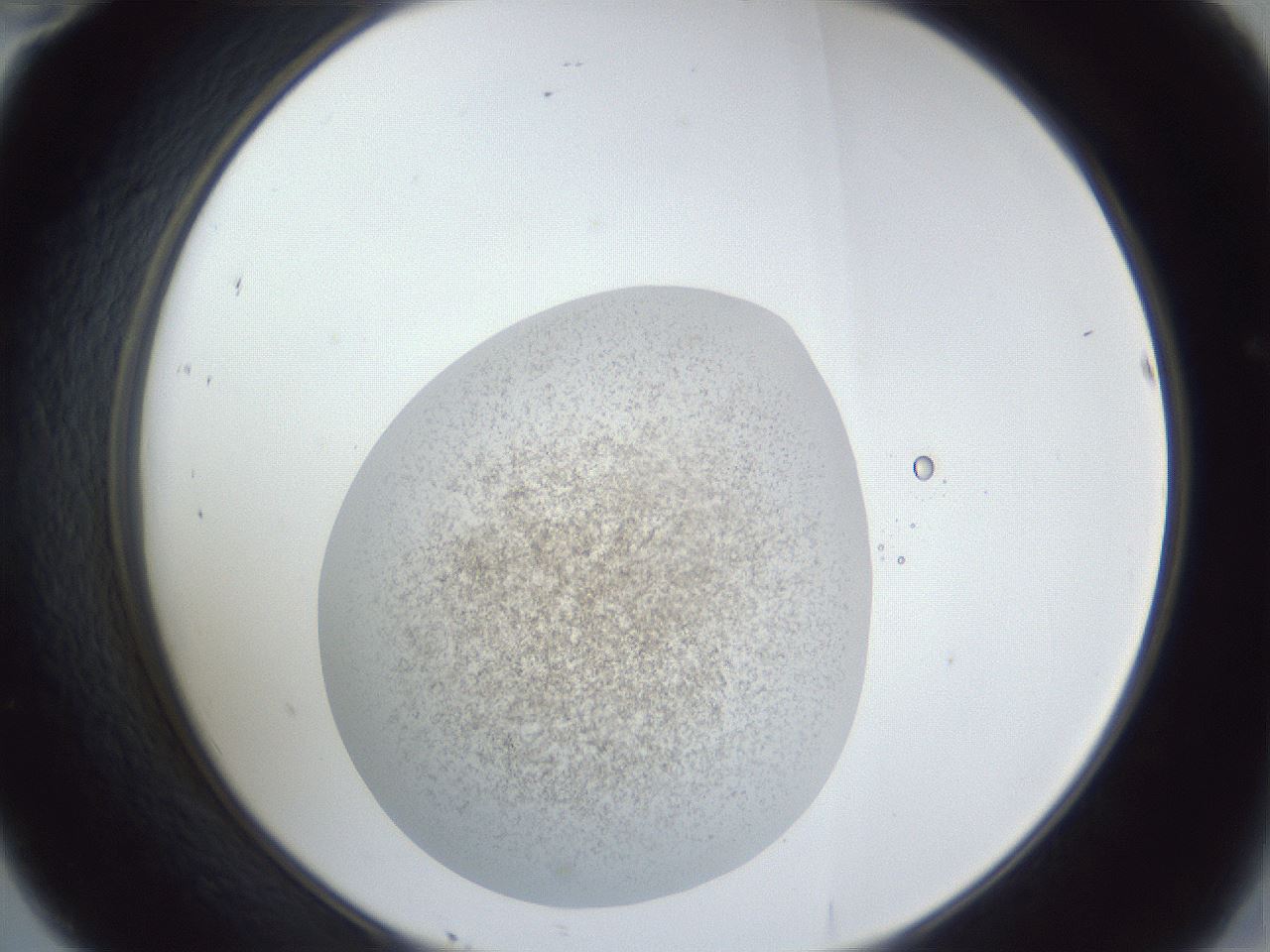 folderID252_plateID1252_batchID3997_wellNum46_profileID1_d2_r72553_ef.jpg