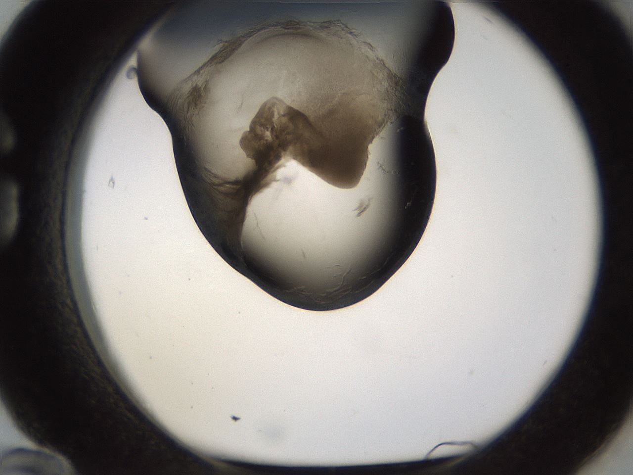 folderID256_plateID1256_batchID4115_wellNum84_profileID1_d1_r72745_ef.jpg
