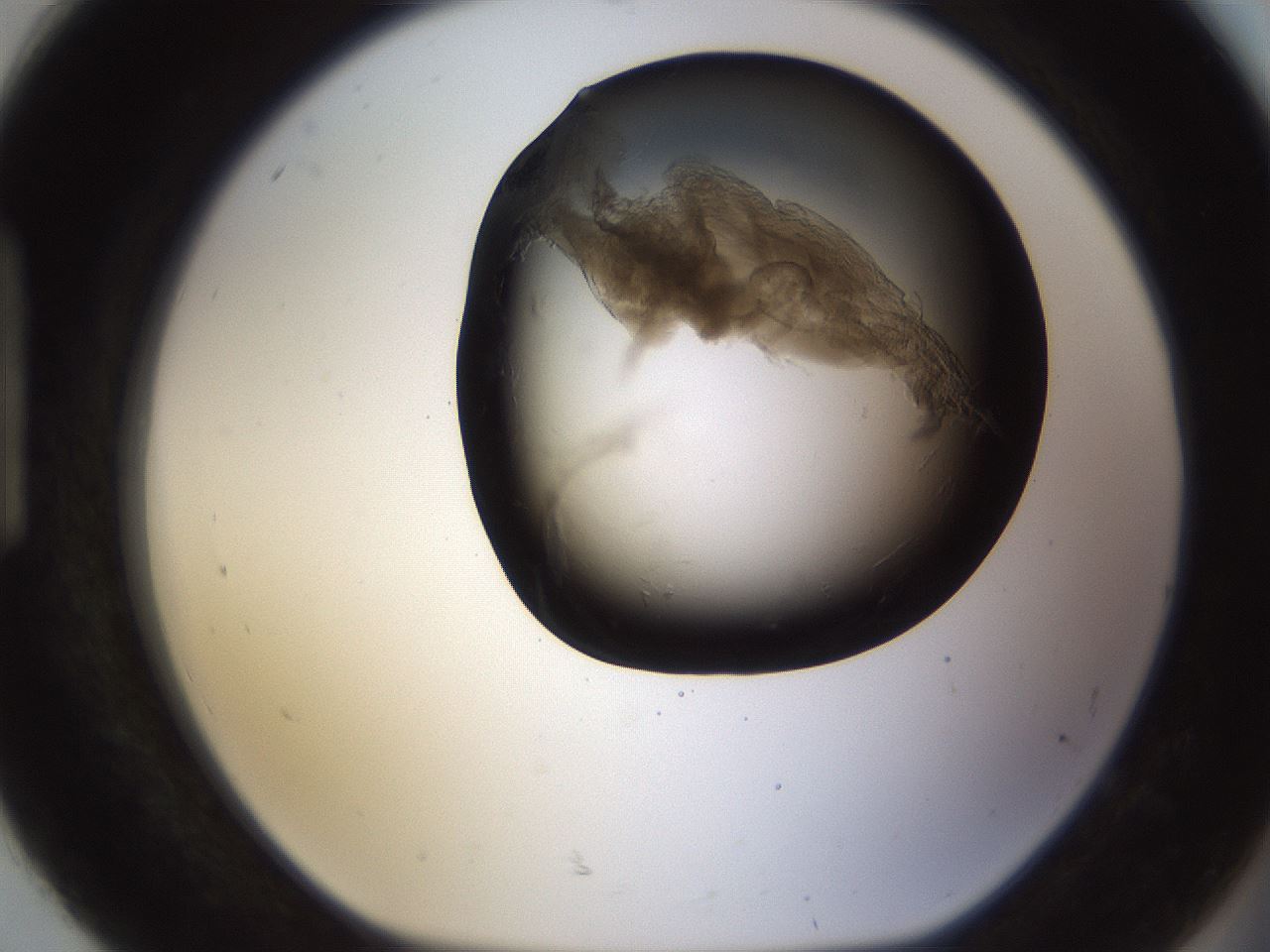 folderID256_plateID1256_batchID4115_wellNum92_profileID1_d1_r72753_ef.jpg