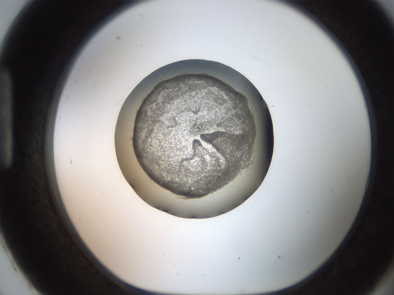 folderID257_plateID2257_batchID10332_wellNum93_profileID1_d1_r156794_ef.jpg