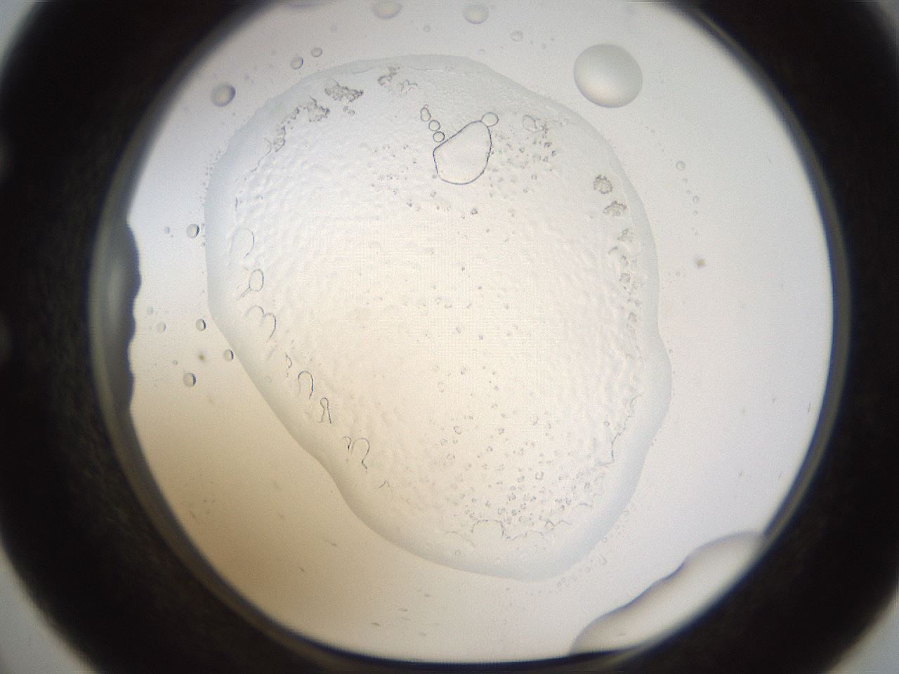folderID593_plateID1593_batchID6726_wellNum57_profileID1_d1_r105700_ef.jpg
