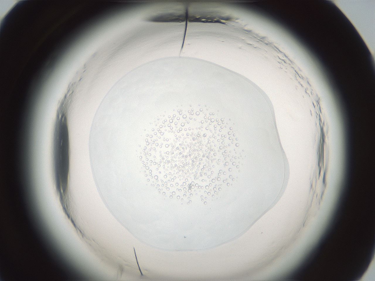 folderID610_plateID2610_batchID13190_wellNum60_profileID1_d1_r206683_ef.jpg