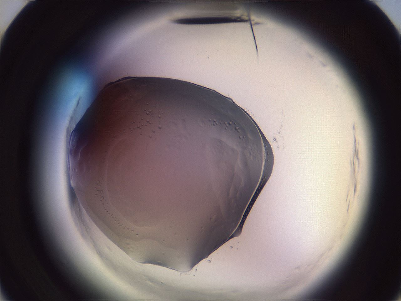 folderID612_plateID2612_batchID13186_wellNum10_profileID1_d3_r205671_ef.jpg