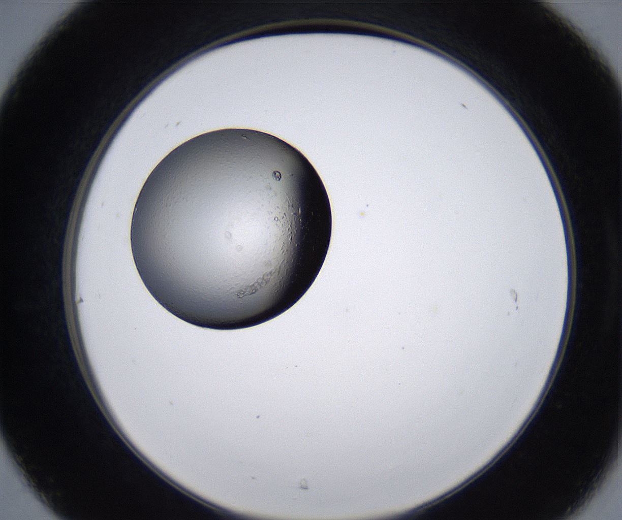 folderID215_plateID2215_batchID10049_wellNum31_profileID1_d2_r150772_ef.jpg