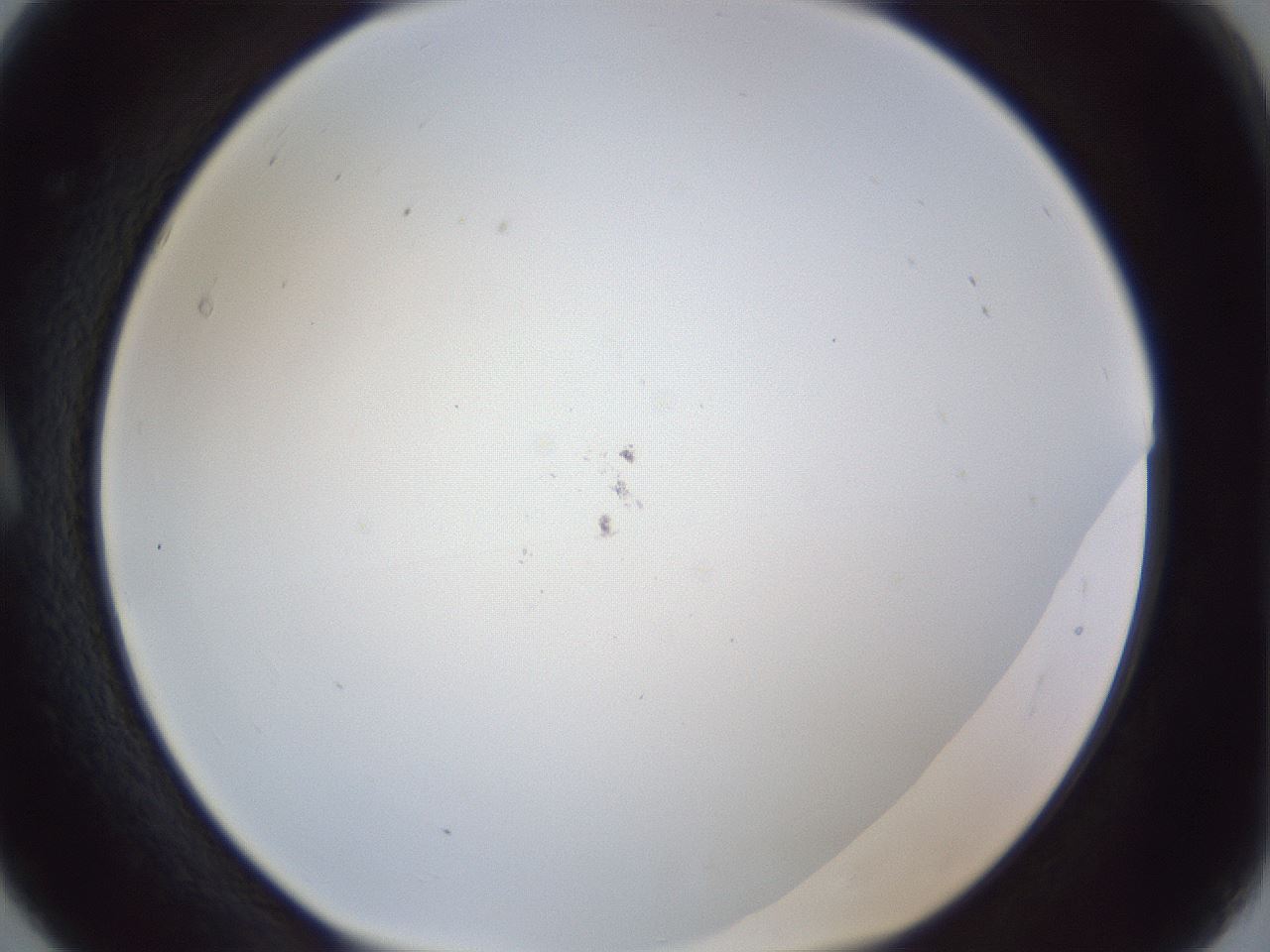 folderID217_plateID1217_batchID3625_wellNum5_profileID1_d1_r68776_ef.jpg