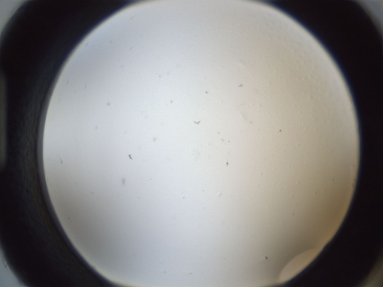 folderID217_plateID1217_batchID3625_wellNum93_profileID1_d1_r68952_ef.jpg