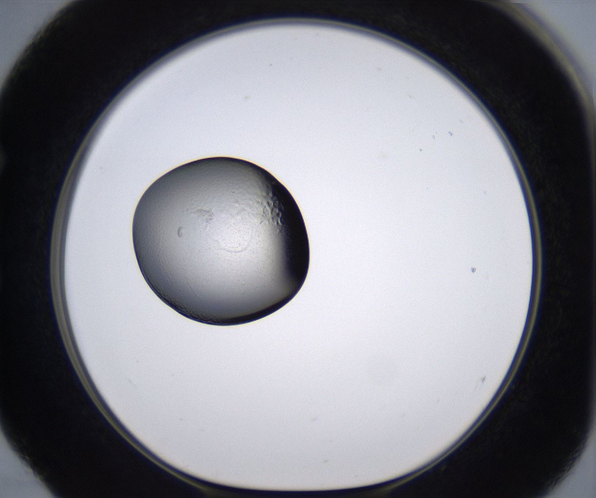 folderID228_plateID2228_batchID10093_wellNum52_profileID1_d1_r153025_ef.jpg