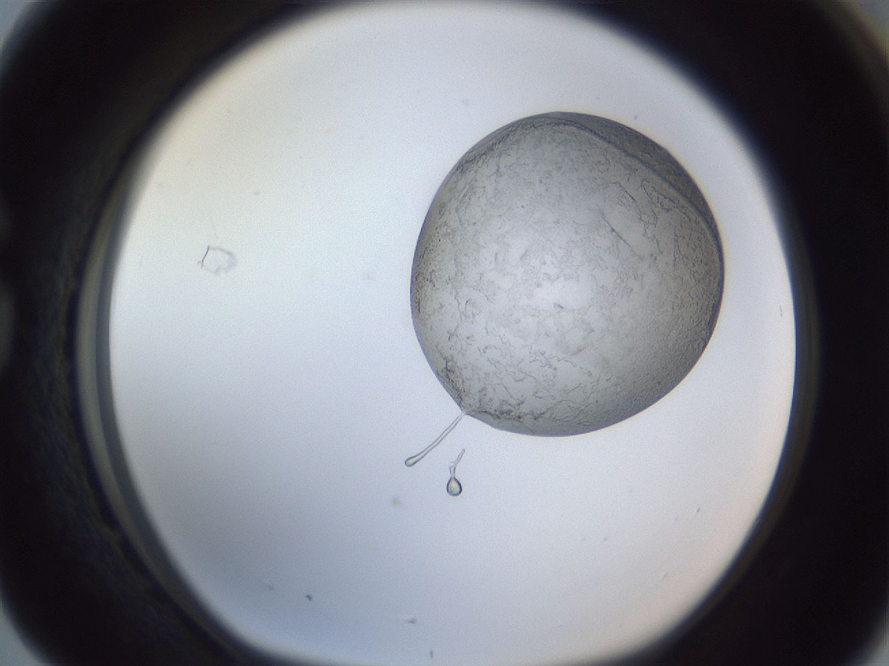 folderID161_plateID1161_batchID3209_wellNum76_profileID1_d1_r63349_ef.jpg