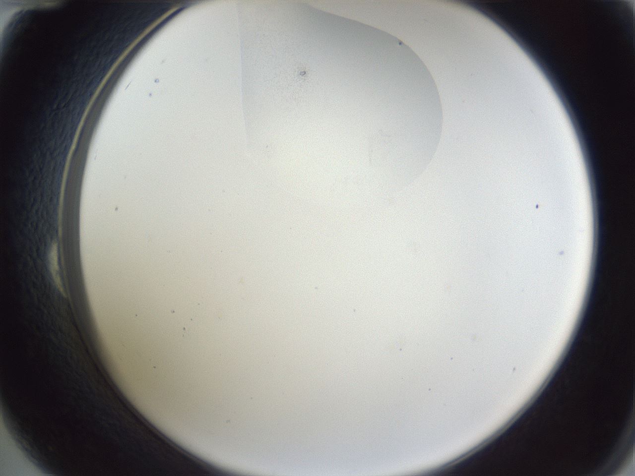 folderID163_plateID1163_batchID3206_wellNum24_profileID1_d2_r62670_ef.jpg