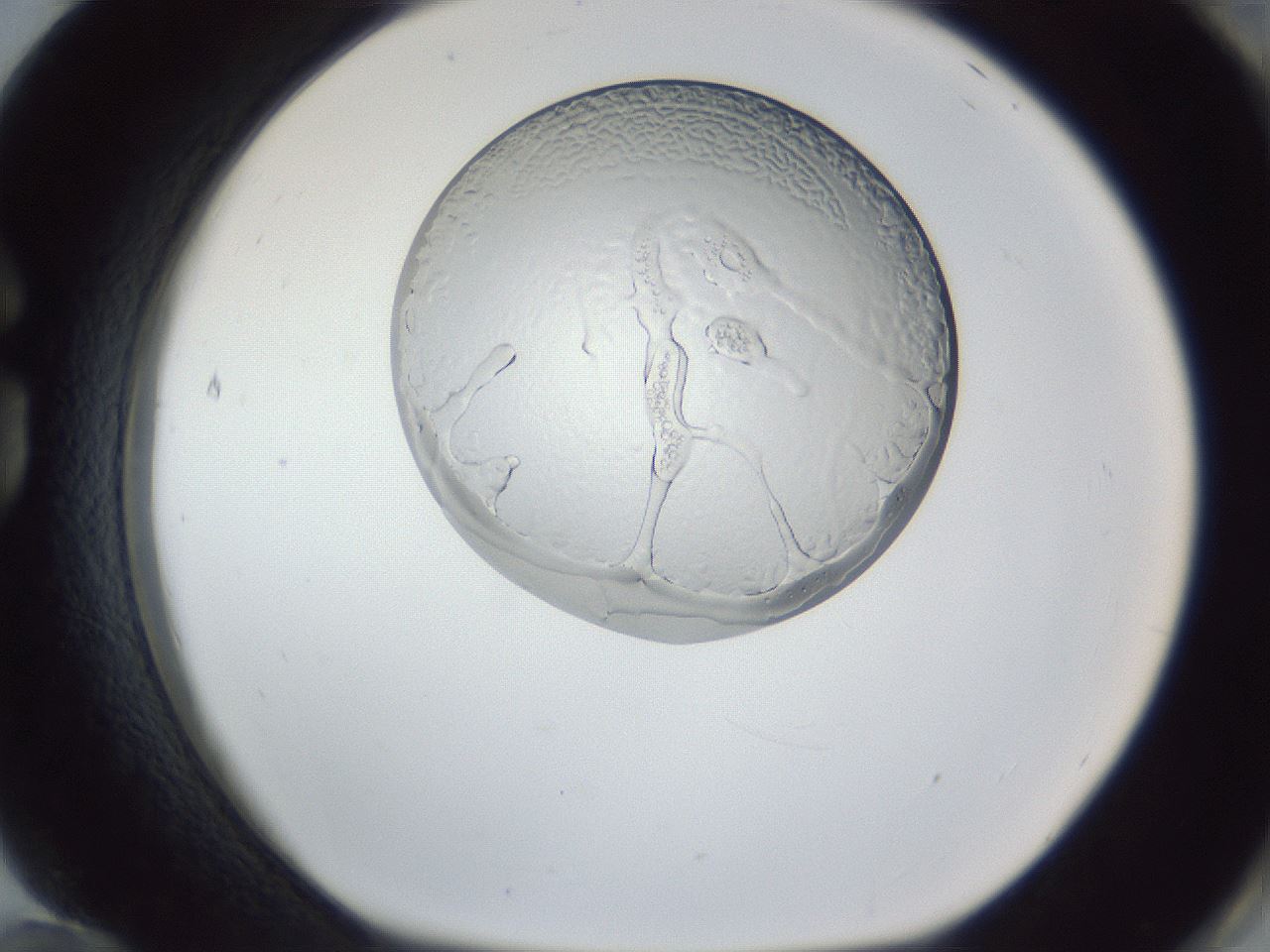 folderID166_plateID1166_batchID3069_wellNum84_profileID1_d1_r61445_ef.jpg