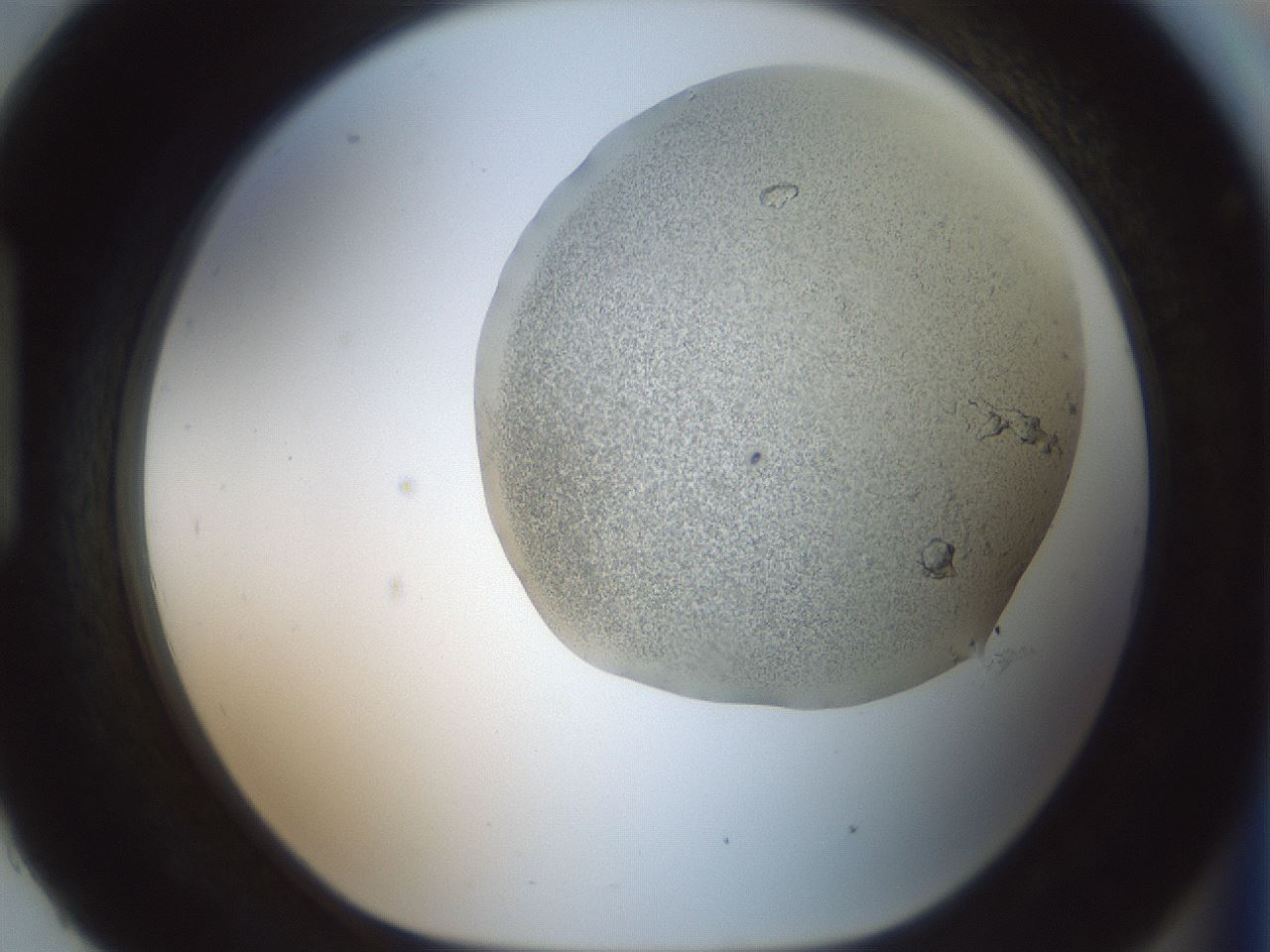 folderID180_plateID1180_batchID3360_wellNum93_profileID1_d1_r65307_ef.jpg