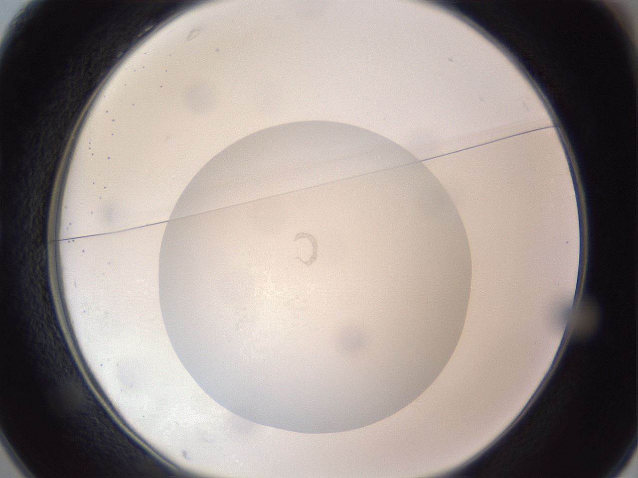 folderID308_plateID1308_batchID4308_wellNum25_profileID1_d1_r78896_ef.jpg