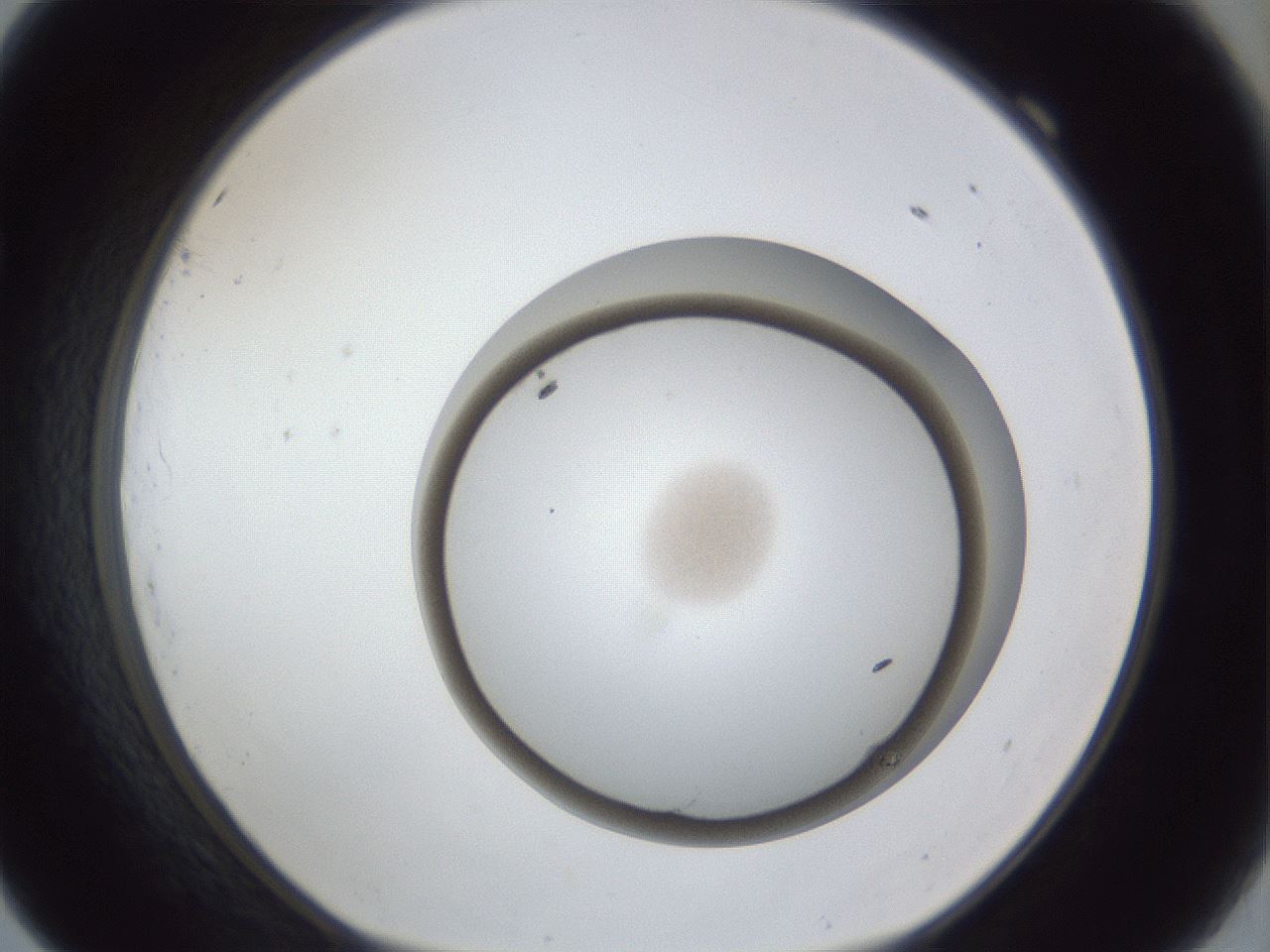 folderID31_plateID1031_batchID1982_wellNum69_profileID1_d1_r44460_ef.jpg