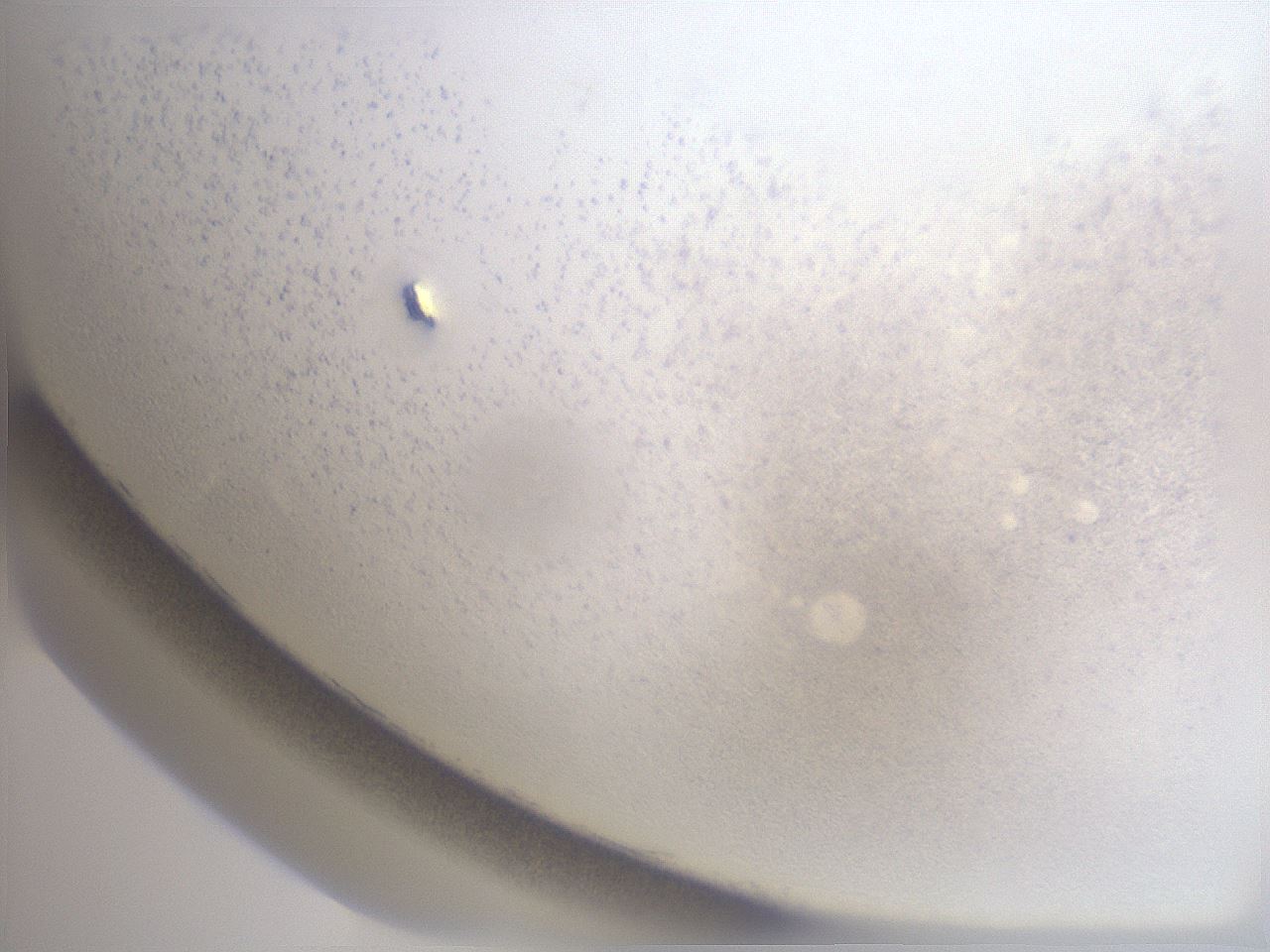 folderID31_plateID1031_batchID1982_wellNum85_profileID1_d1_r47309_ef.jpg
