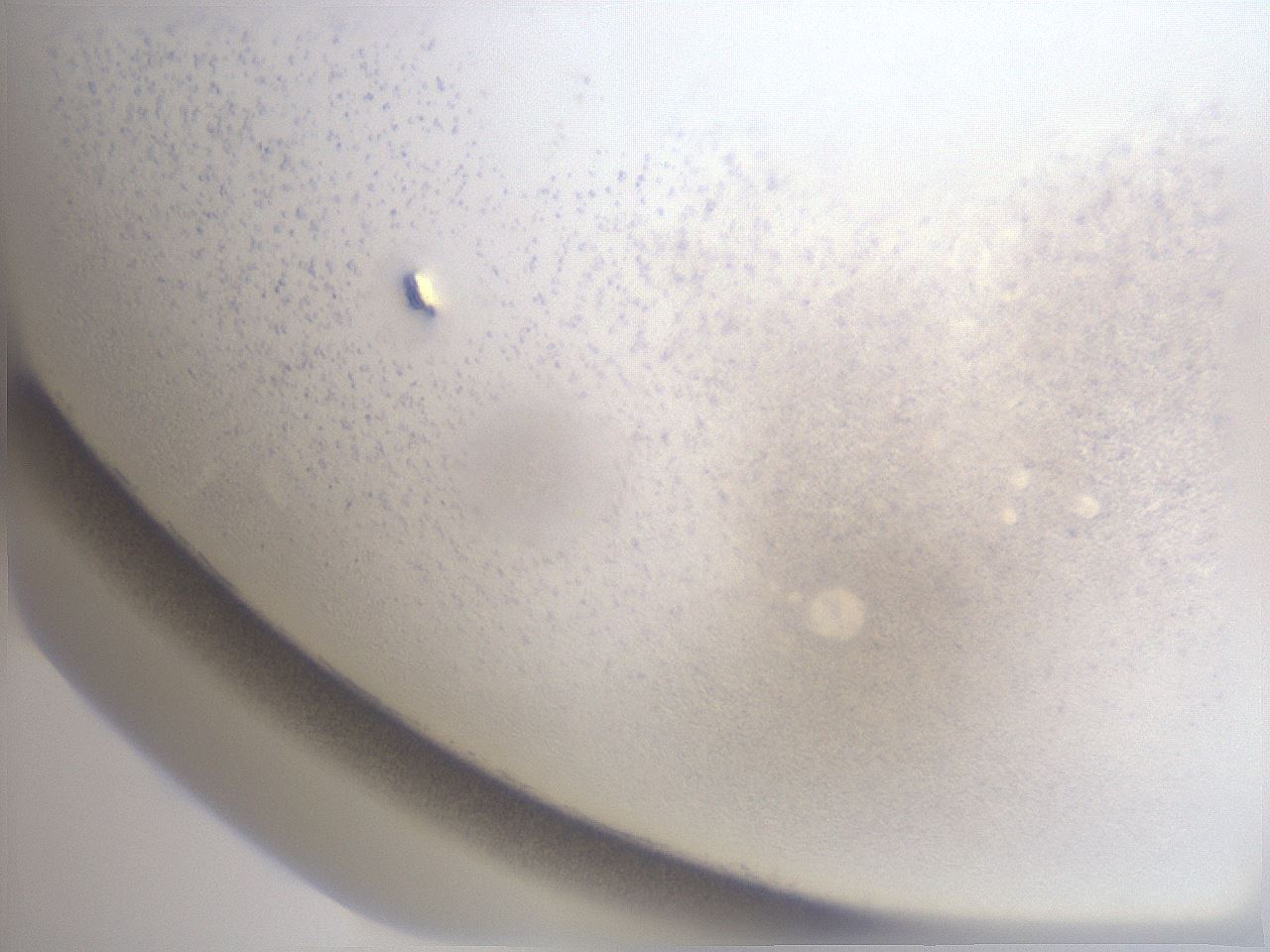 folderID31_plateID1031_batchID1999_wellNum85_profileID1_d1_r47309_ef.jpg
