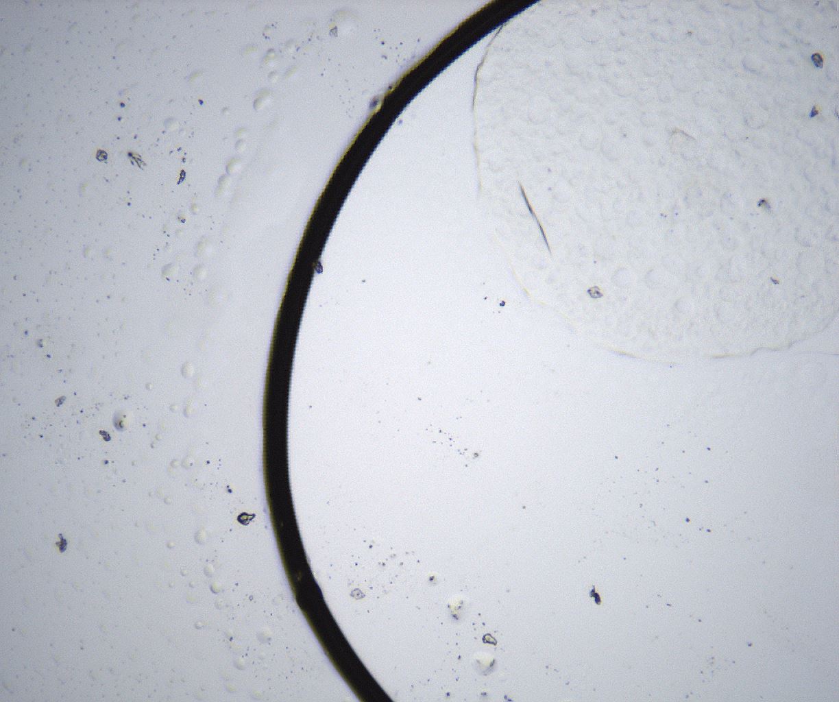 folderID343_plateID2343_batchID11025_wellNum96_profileID1_d1_r165185_ef.jpg