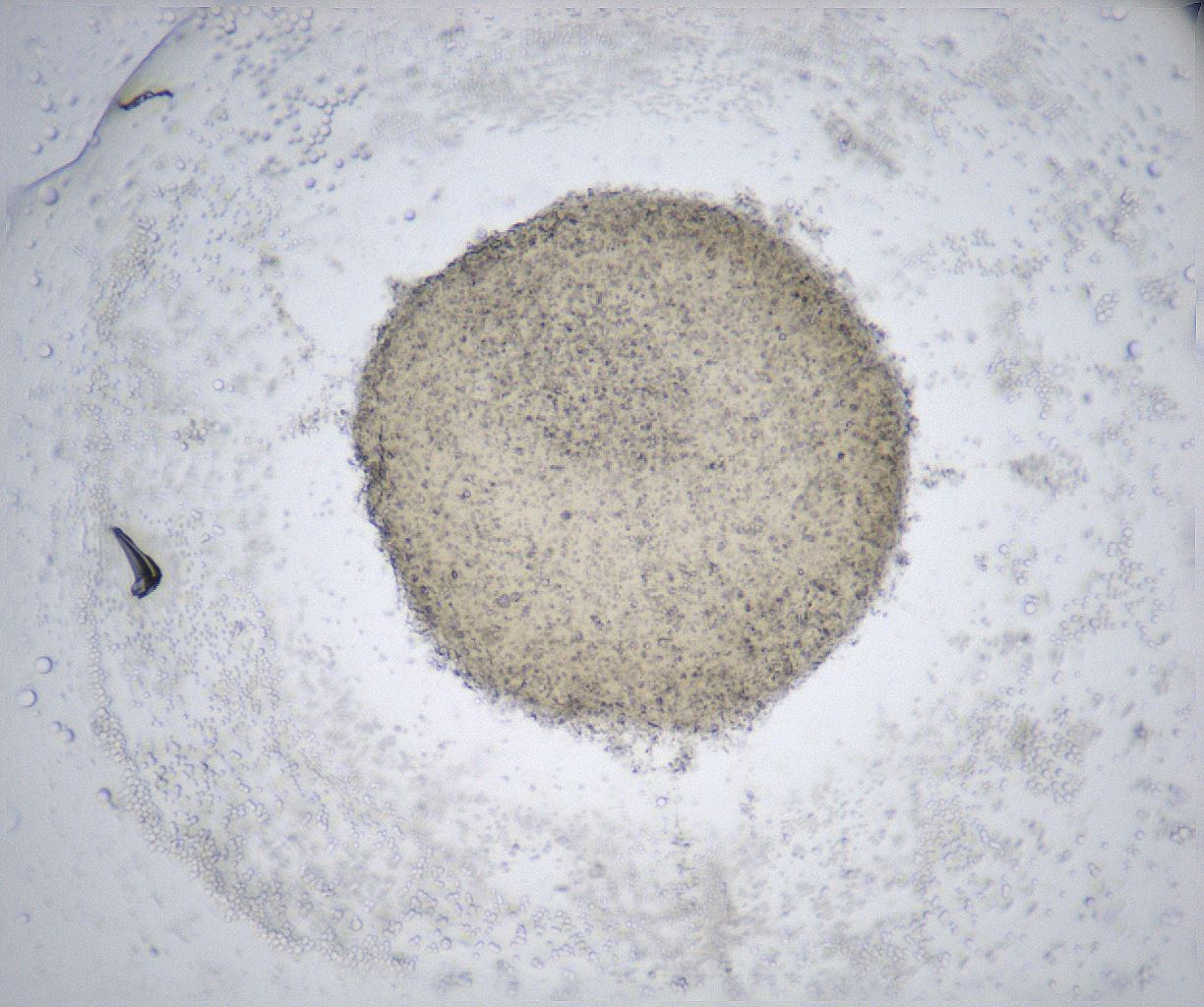 folderID361_plateID2361_batchID11084_wellNum14_profileID1_d1_r167805_ef.jpg