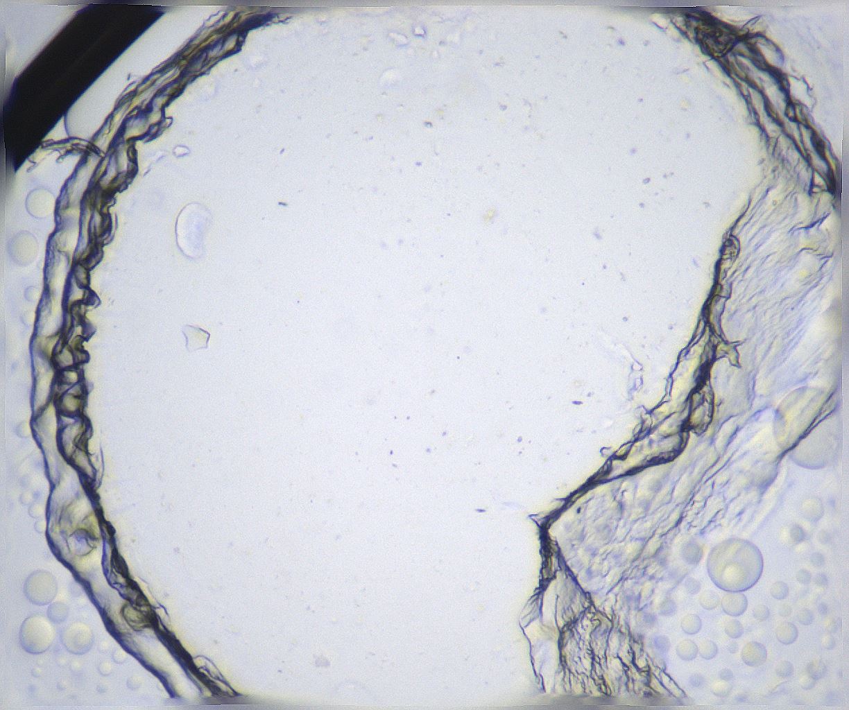 folderID361_plateID2361_batchID11084_wellNum91_profileID1_d1_r167959_ef.jpg