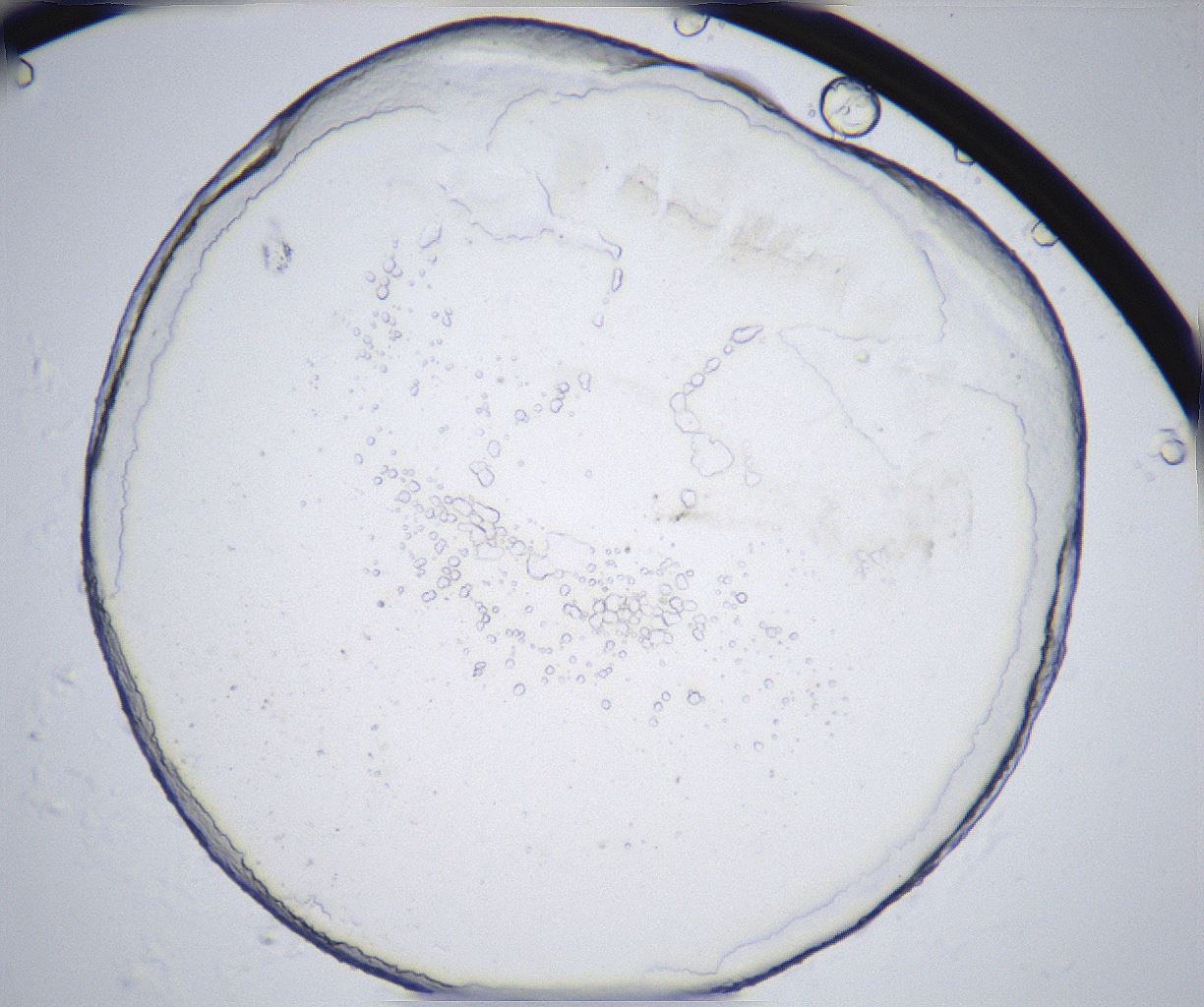folderID362_plateID2362_batchID11079_wellNum66_profileID1_d1_r167525_ef.jpg