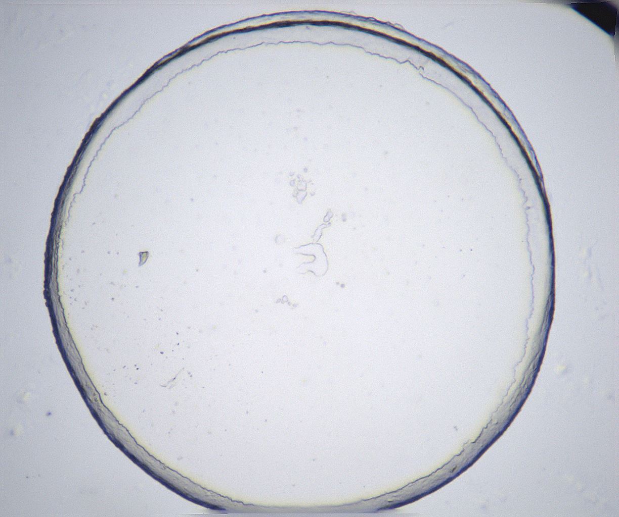 folderID362_plateID2362_batchID11079_wellNum79_profileID1_d1_r167551_ef.jpg