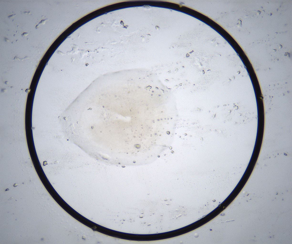 folderID370_plateID2370_batchID11110_wellNum56_profileID1_d1_r169809_ef.jpg
