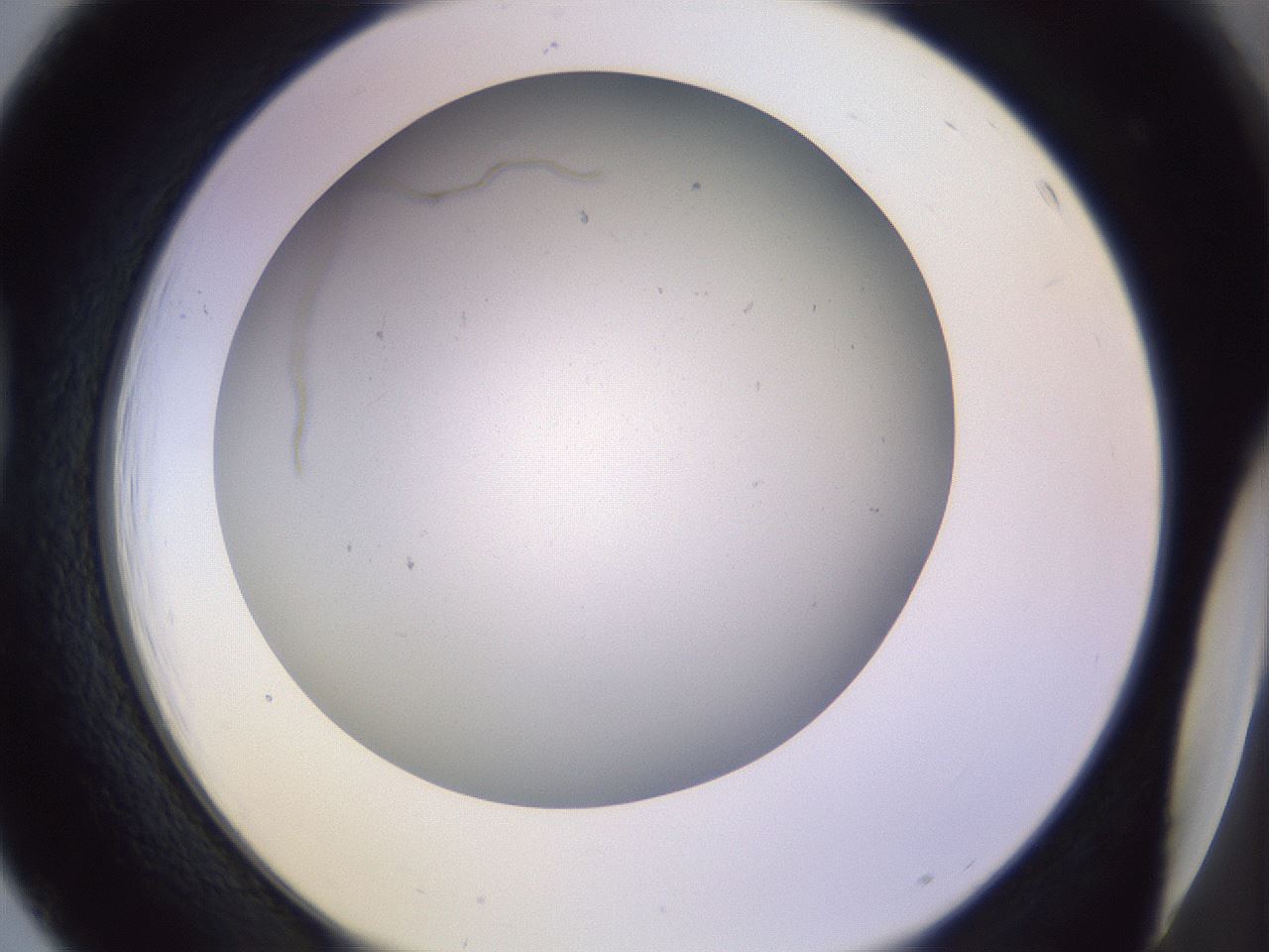 folderID372_plateID1372_batchID4734_wellNum39_profileID1_d1_r83382_ef.jpg