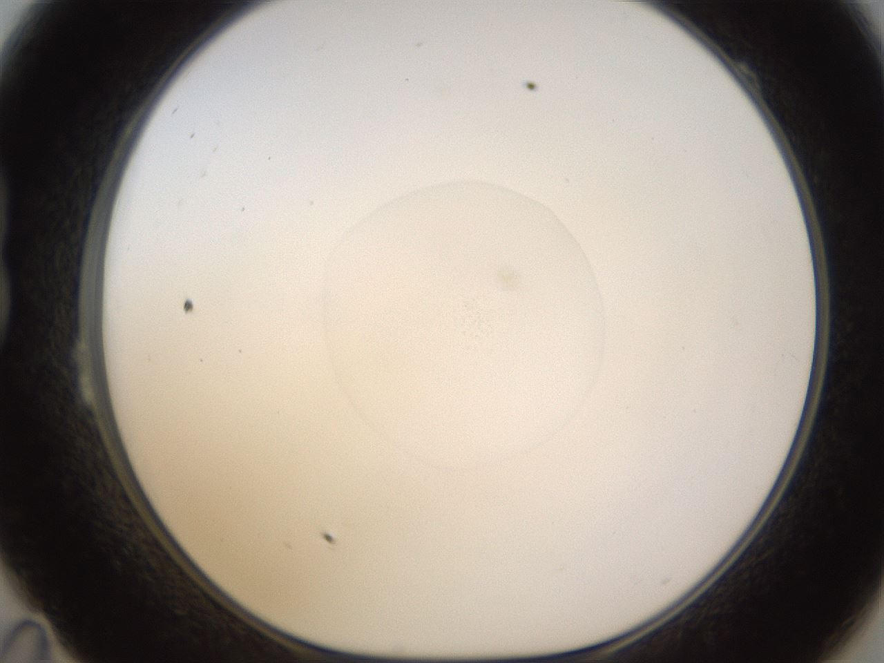 folderID398_plateID1398_batchID5055_wellNum23_profileID1_d1_r85384_ef.jpg