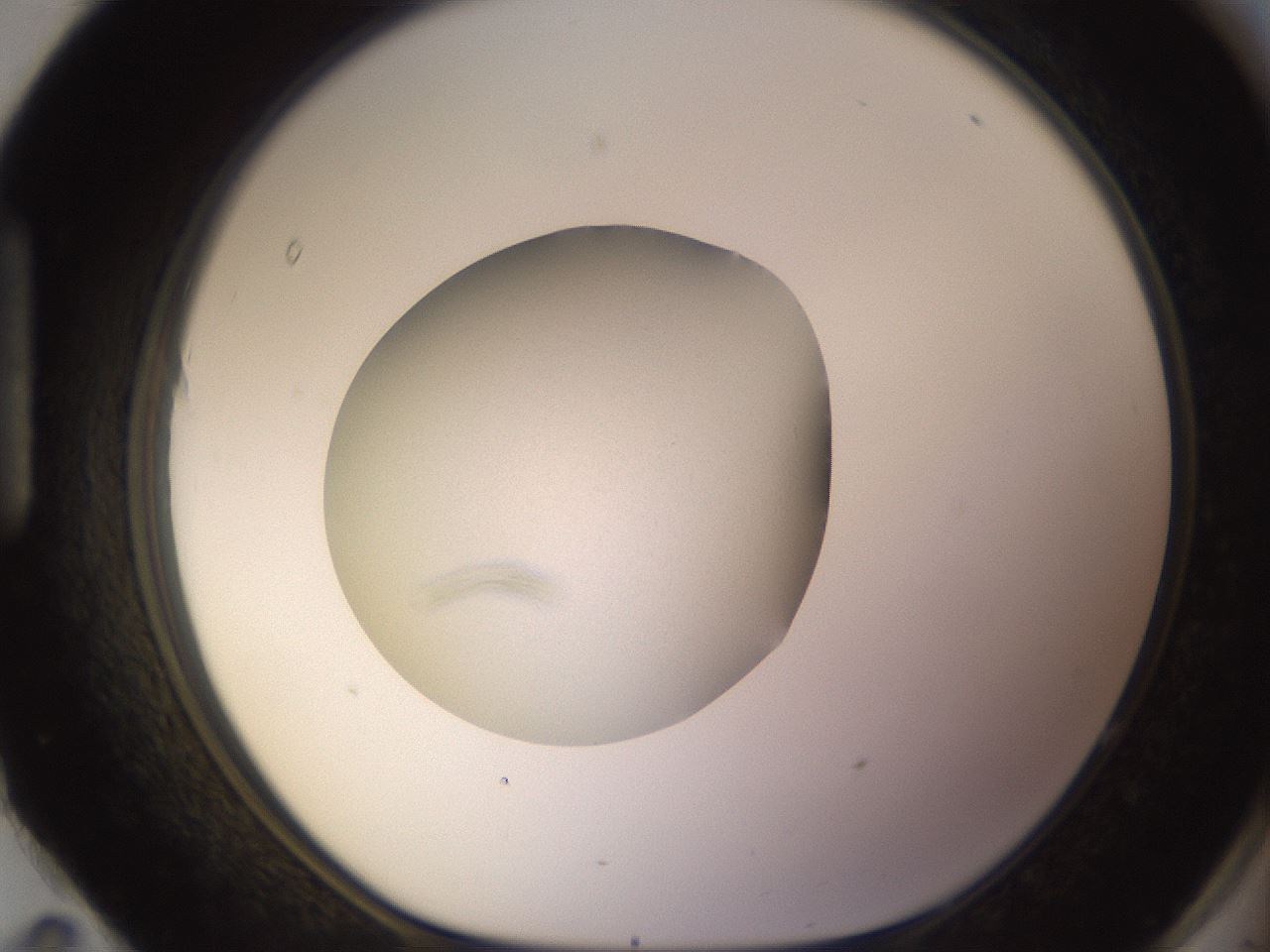 folderID398_plateID1398_batchID5055_wellNum95_profileID1_d1_r85456_ef.jpg