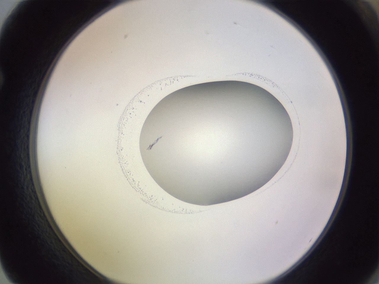 folderID417_plateID1417_batchID5188_wellNum62_profileID1_d1_r86671_ef.jpg