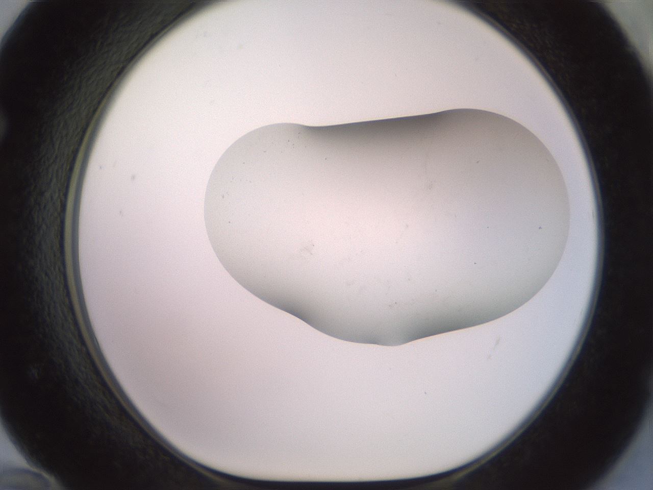 folderID417_plateID2417_batchID11657_wellNum72_profileID1_d1_r179143_ef.jpg