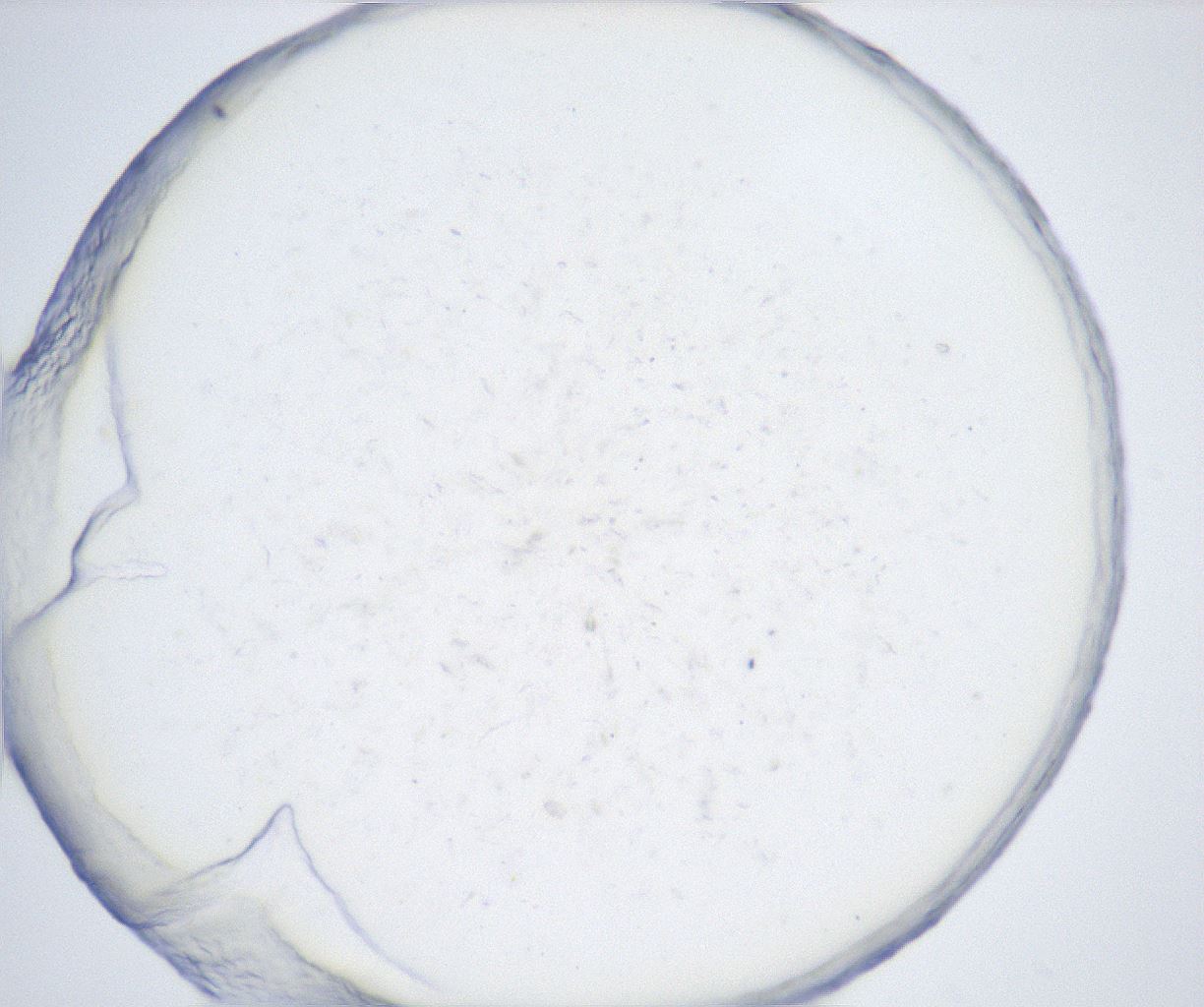 folderID431_plateID2431_batchID11763_wellNum81_profileID1_d1_r180960_ef.jpg