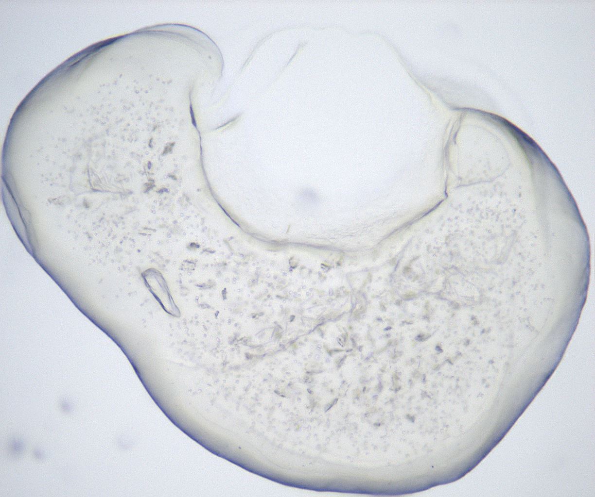 folderID432_plateID2432_batchID11736_wellNum71_profileID1_d1_r185260_ef.jpg
