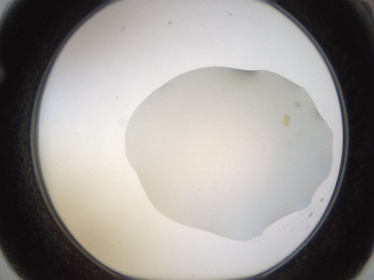 folderID461_plateID1461_batchID5591_wellNum62_profileID1_d1_r92602_ef.jpg
