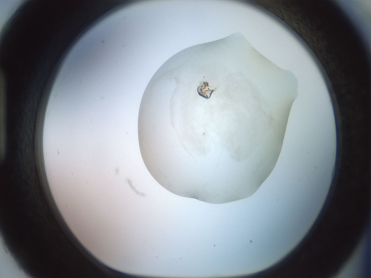 folderID500_plateID2500_batchID12080_wellNum93_profileID1_d1_r188056_ef.jpg