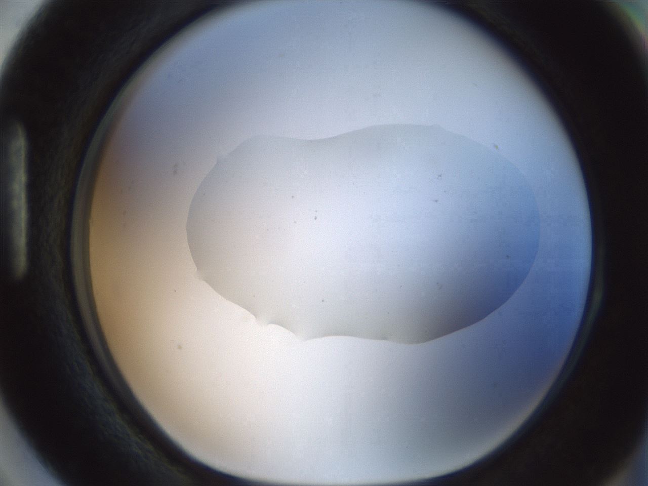 folderID510_plateID1510_batchID5851_wellNum87_profileID1_d1_r95719_ef.jpg