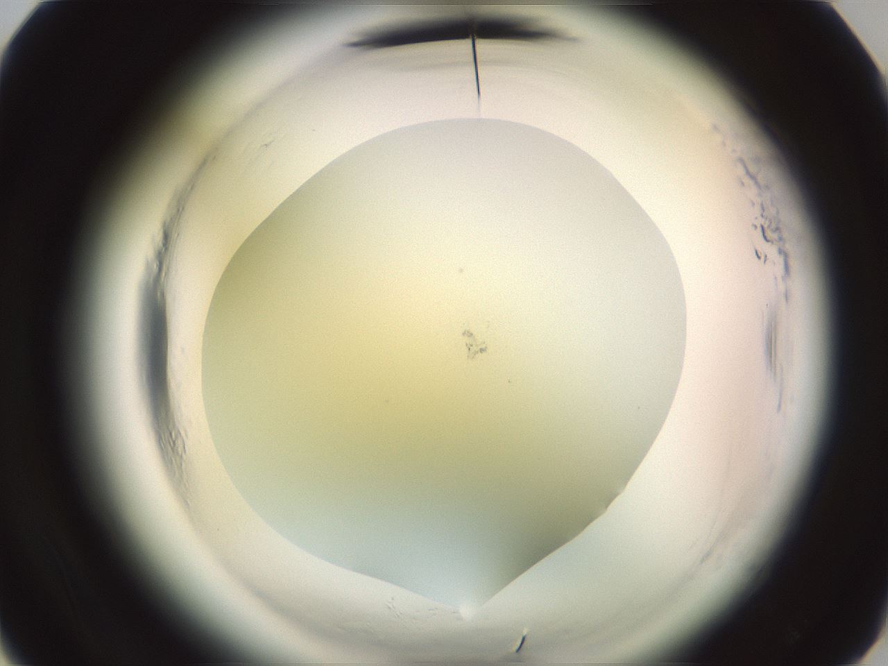 folderID576_plateID2576_batchID13156_wellNum17_profileID1_d3_r197627_ef.jpg