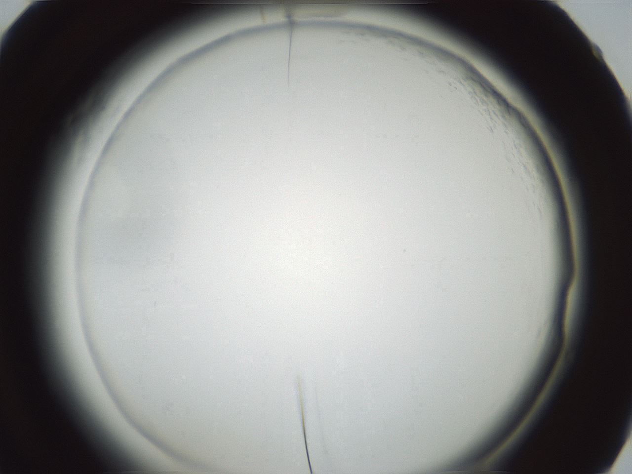 folderID585_plateID2585_batchID13185_wellNum60_profileID1_d2_r205244_ef.jpg