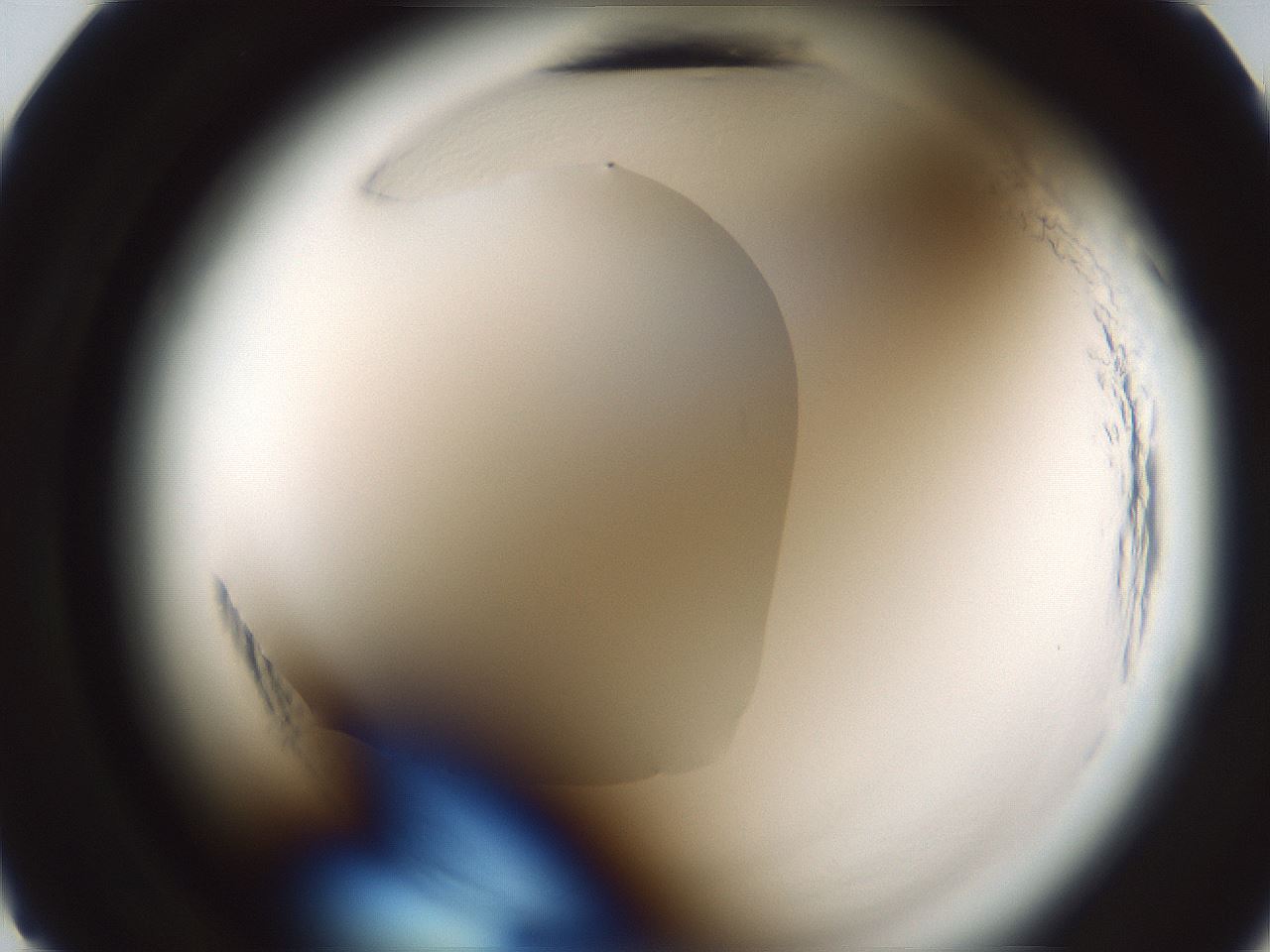 folderID586_plateID2586_batchID13188_wellNum11_profileID1_d2_r205961_ef.jpg