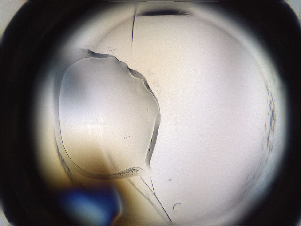 folderID590_plateID2590_batchID13170_wellNum10_profileID1_d2_r201061_ef.jpg